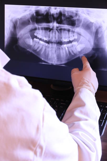Best Emergency Root Canal Therapy in Wilder, VT